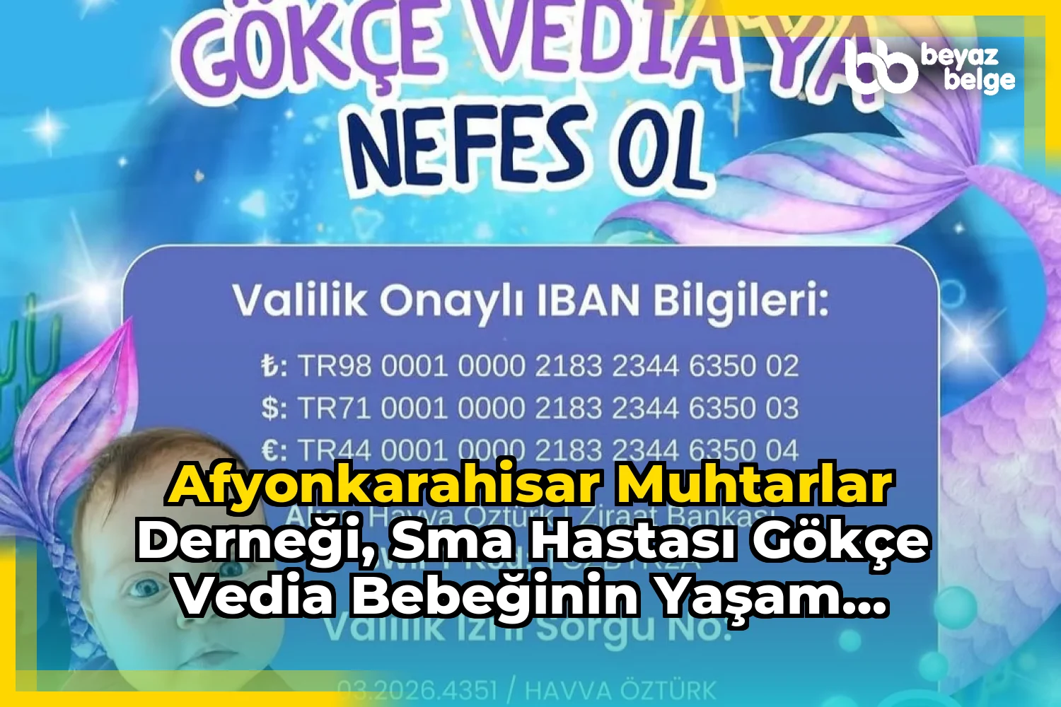 Afyonkarahisar Muhtarlar Derneği, SMA Hastası Gökçe Vedia Bebeğinin Yaşam Mücadelesine Destek Çağrısı Yaptı