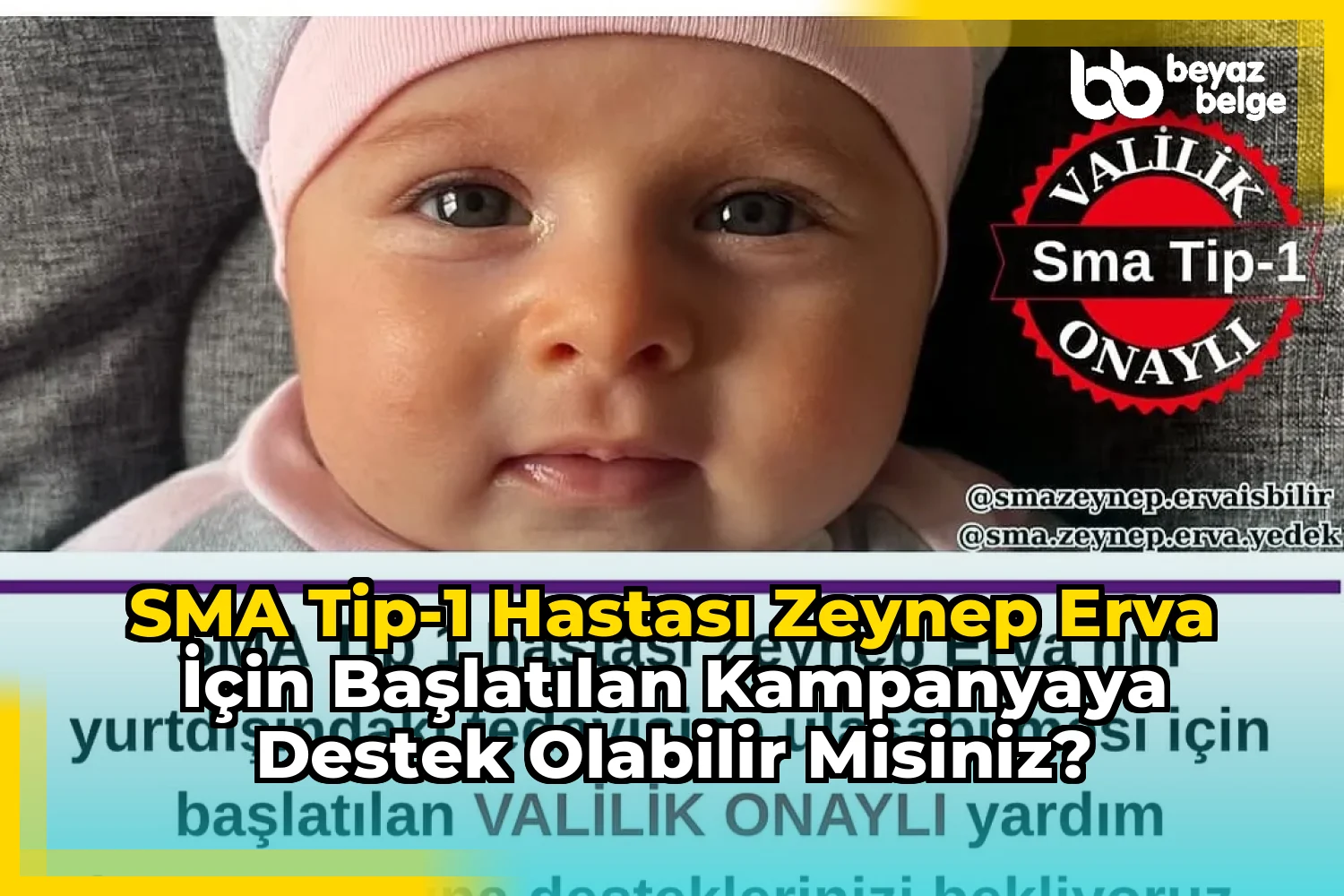 SMA Tip-1 hastası Zeynep Erva için başlatılan kampanyaya destek olabilir misiniz?